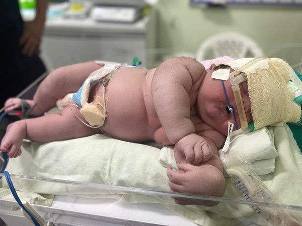 bebe gigante whatsapp-image-2023-01-18-at-19.49.01