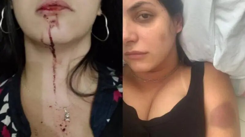 mulher denunciaou22_agressoes_do_amrido_widelg